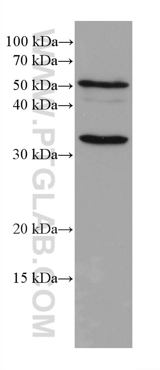 WB analysis of C6 using 66140-1-Ig