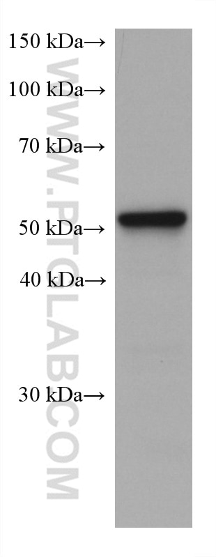 Western Blot (WB) analysis of rat brain tissue using C9orf72 Monoclonal antibody (67824-1-Ig)