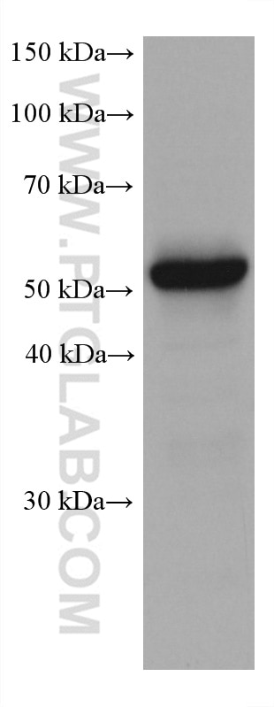 Western Blot (WB) analysis of mouse brain tissue using C9orf72 Monoclonal antibody (67824-1-Ig)