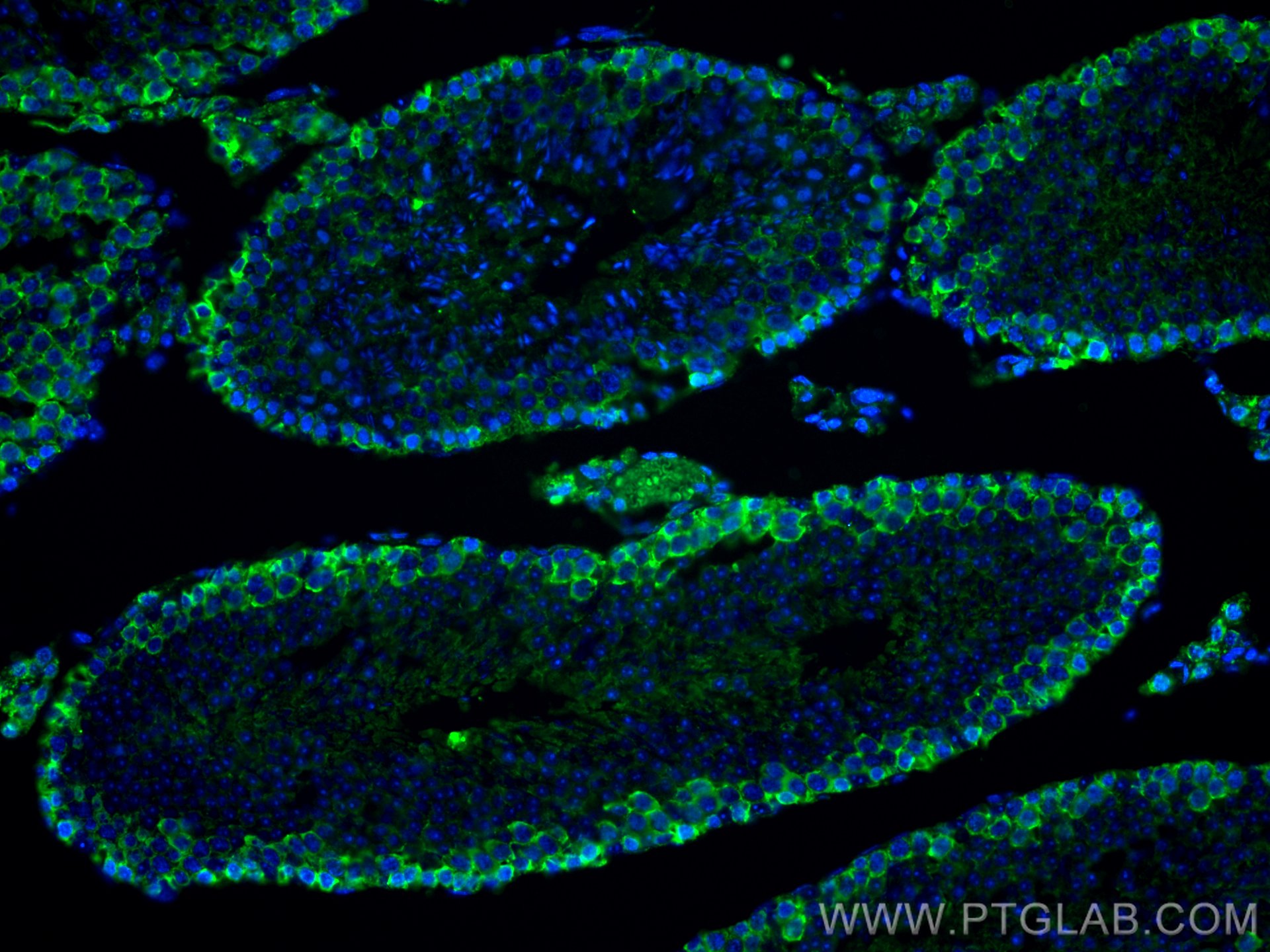 Immunofluorescence (IF) / fluorescent staining of mouse testis tissue using CoraLite® Plus 488-conjugated C9orf72 Polyclonal a (CL488-22637)