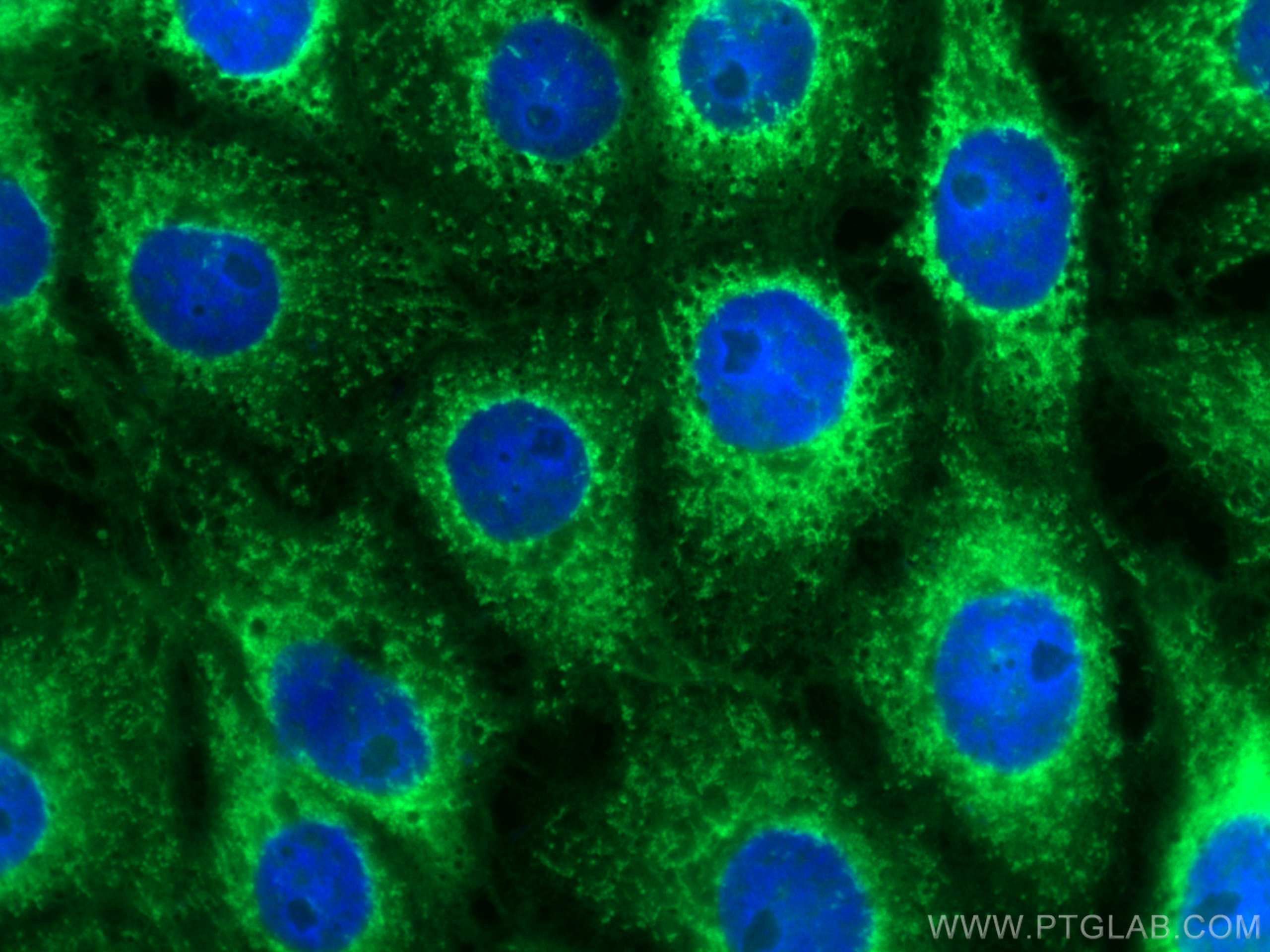 Immunofluorescence (IF) / fluorescent staining of SH-SY5Y cells using CoraLite® Plus 488-conjugated C9orf72 Monoclonal a (CL488-66140)