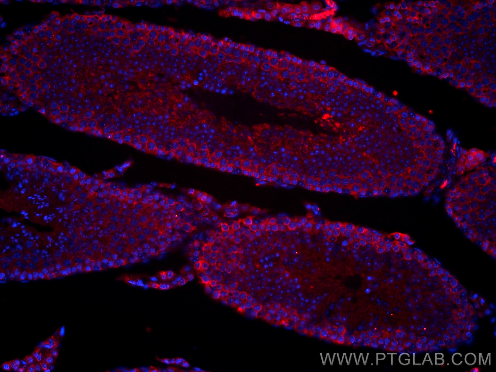 Immunofluorescence (IF) / fluorescent staining of mouse testis tissue using CoraLite®594-conjugated C9orf72 Polyclonal antibod (CL594-22637)