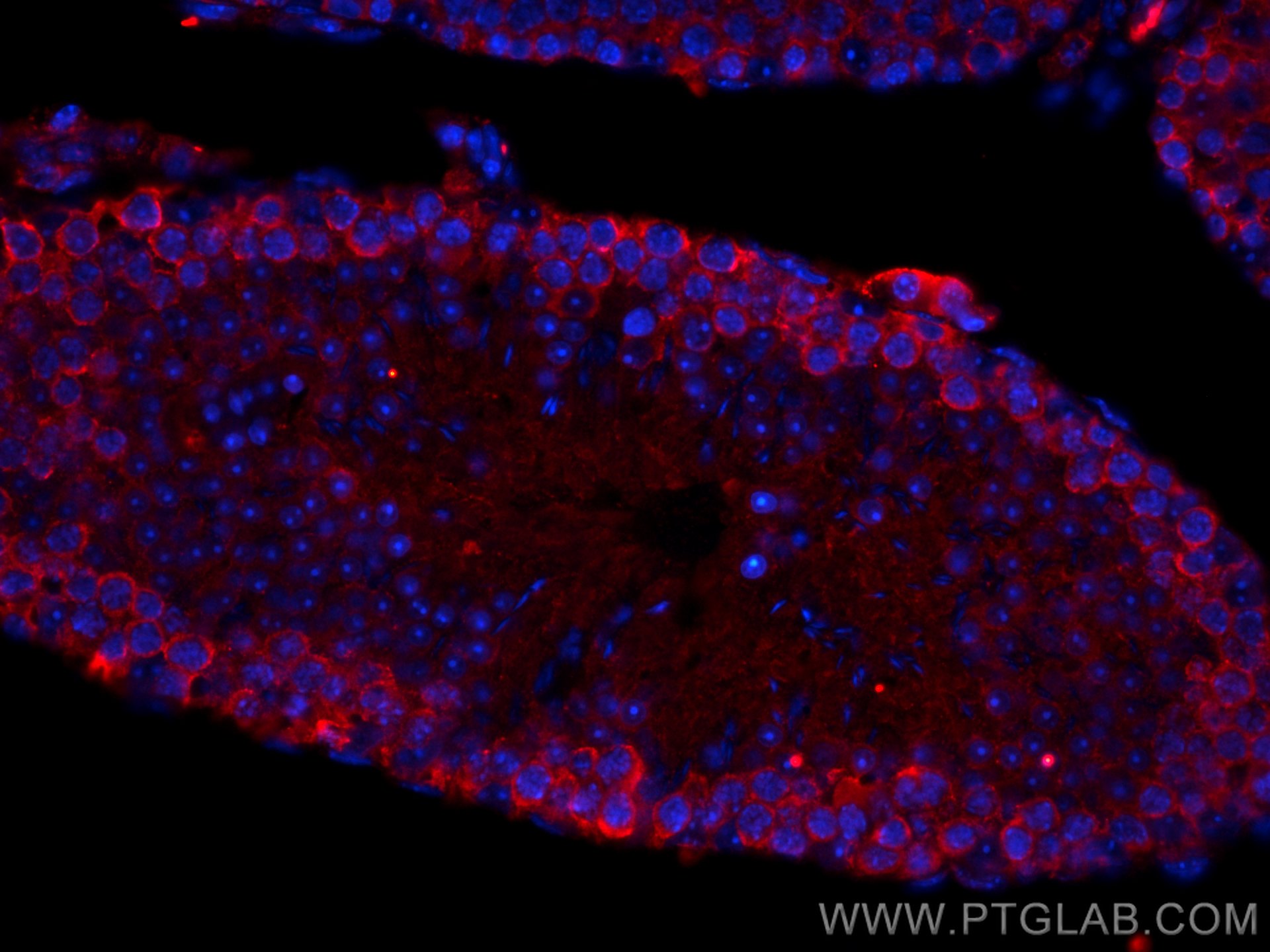 Immunofluorescence (IF) / fluorescent staining of mouse testis tissue using CoraLite®594-conjugated C9orf72 Polyclonal antibod (CL594-22637)