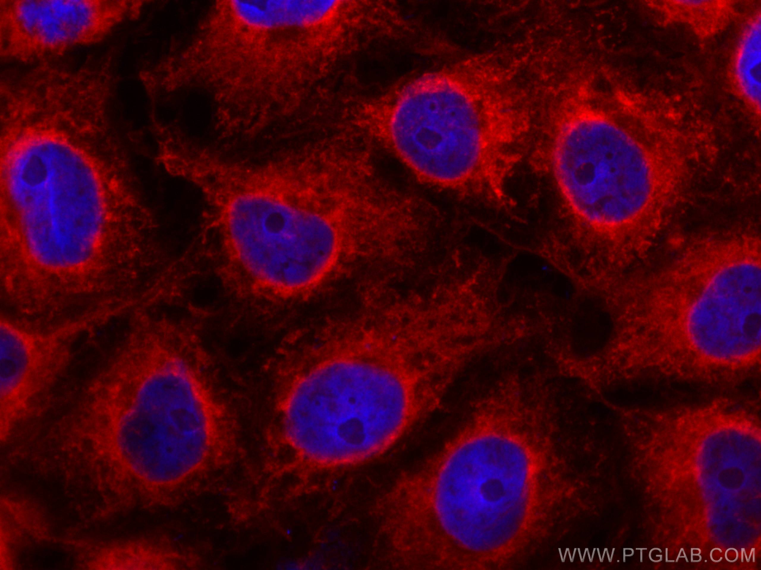 Immunofluorescence (IF) / fluorescent staining of SH-SY5Y cells using CoraLite®594-conjugated C9orf72 Monoclonal antibod (CL594-66140)