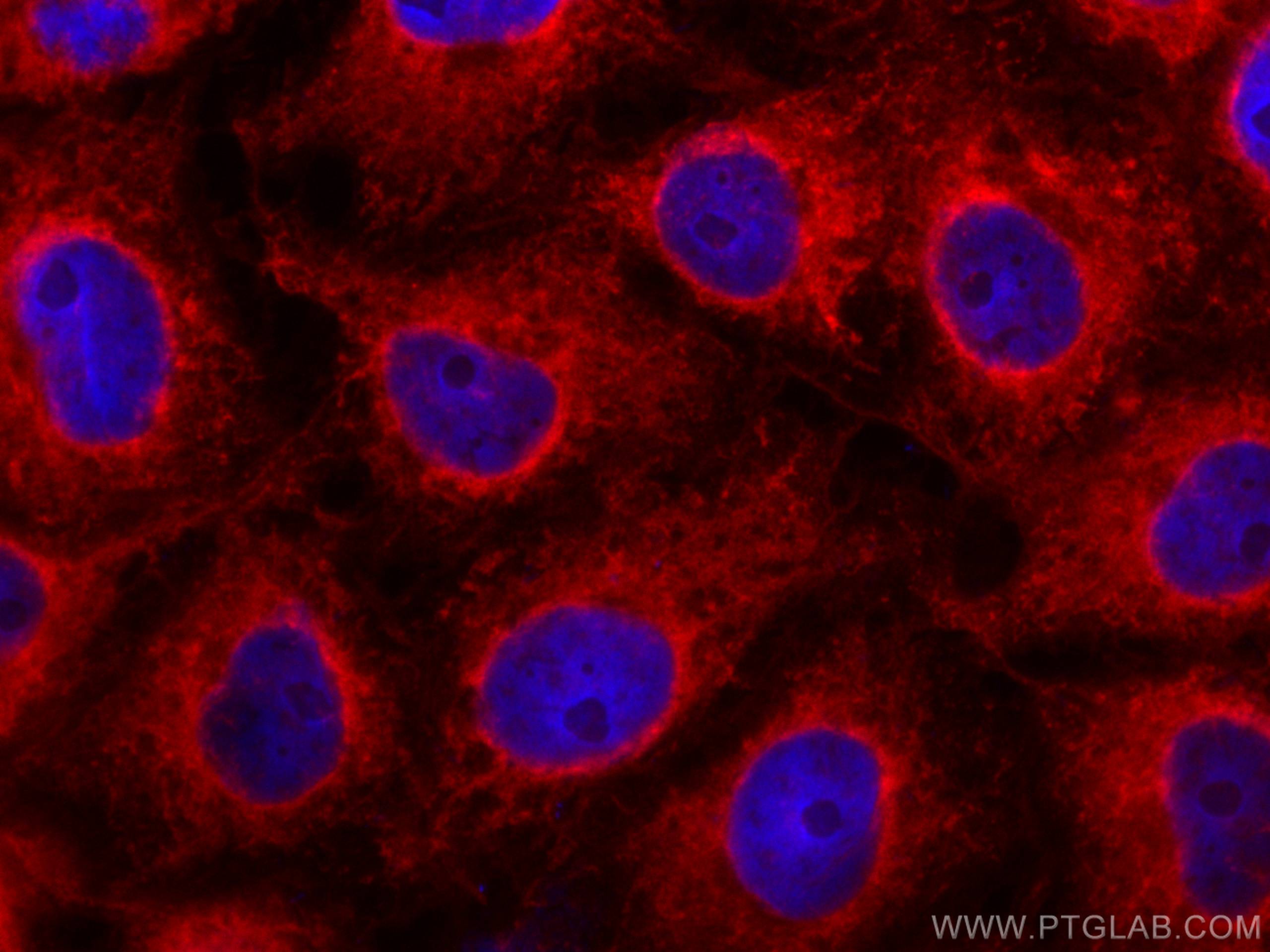 IF Staining of SH-SY5Y using CL594-66140