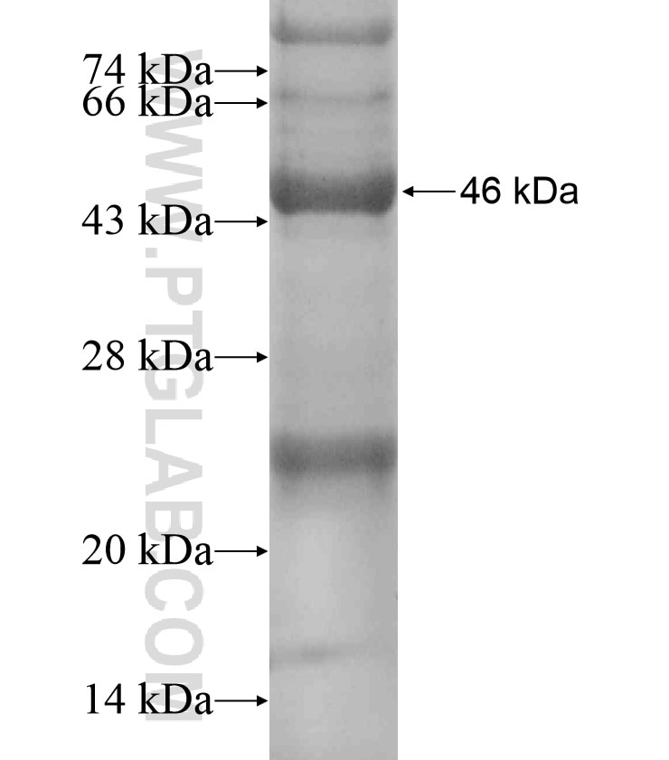 C9orf72 fusion protein Ag18326 SDS-PAGE