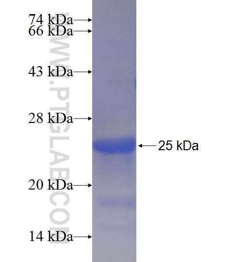 C9orf72 fusion protein Ag21080 SDS-PAGE