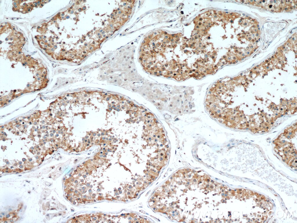 Immunohistochemistry (IHC) staining of human testis tissue using C9orf78 Polyclonal antibody (14496-1-AP)