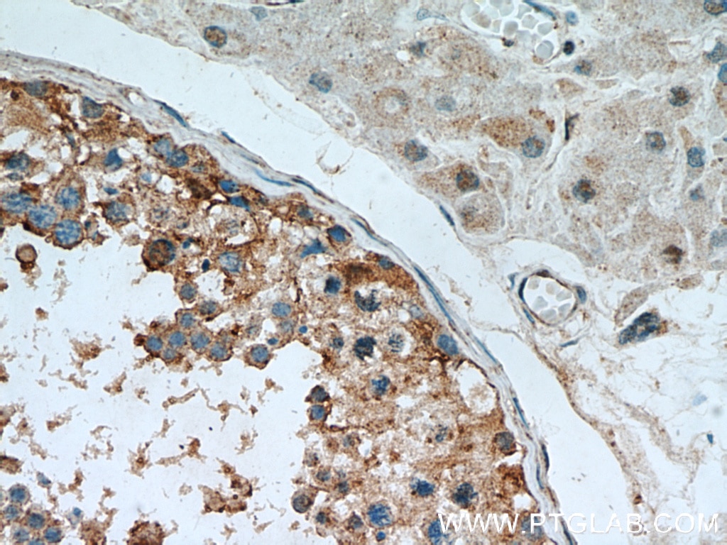 Immunohistochemistry (IHC) staining of human testis tissue using C9orf78 Polyclonal antibody (14496-1-AP)