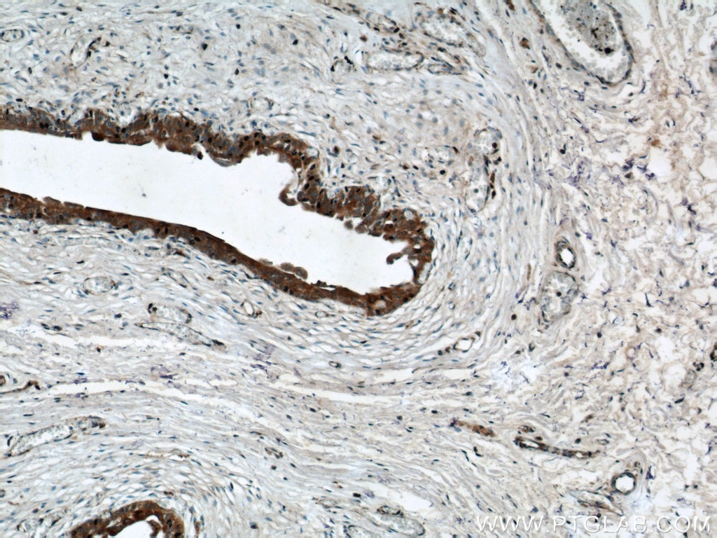 Immunohistochemistry (IHC) staining of human bladder tissue using C9orf78 Polyclonal antibody (14496-1-AP)