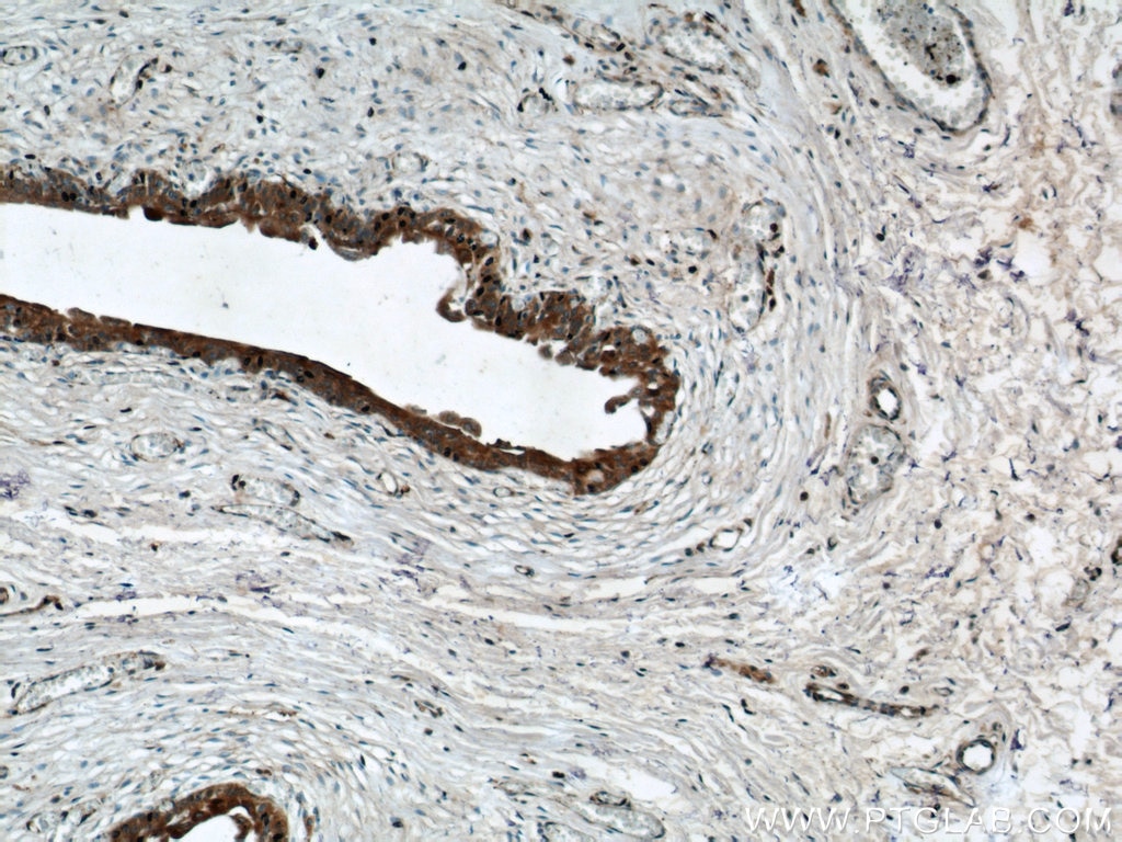 IHC staining of human bladder using 14496-1-AP