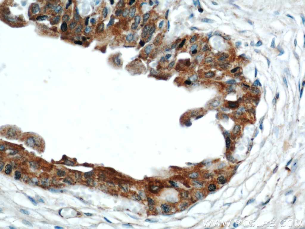 Immunohistochemistry (IHC) staining of human bladder tissue using C9orf78 Polyclonal antibody (14496-1-AP)