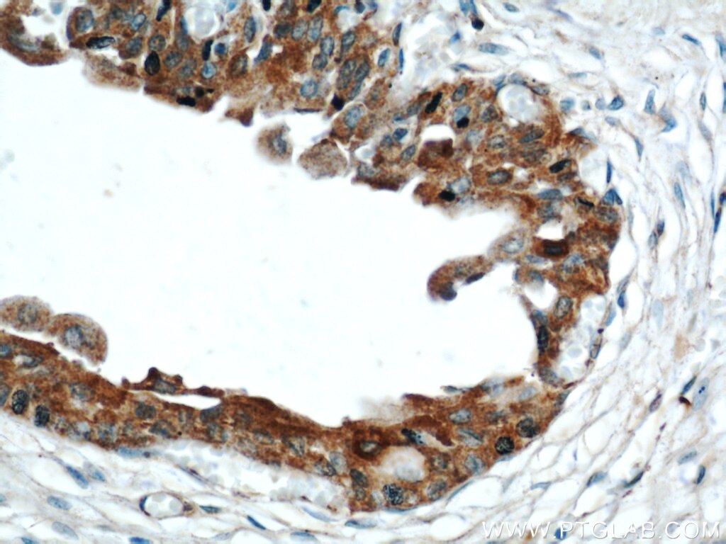 IHC staining of human bladder using 14496-1-AP