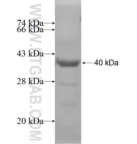 C9orf78 fusion protein Ag5919 SDS-PAGE
