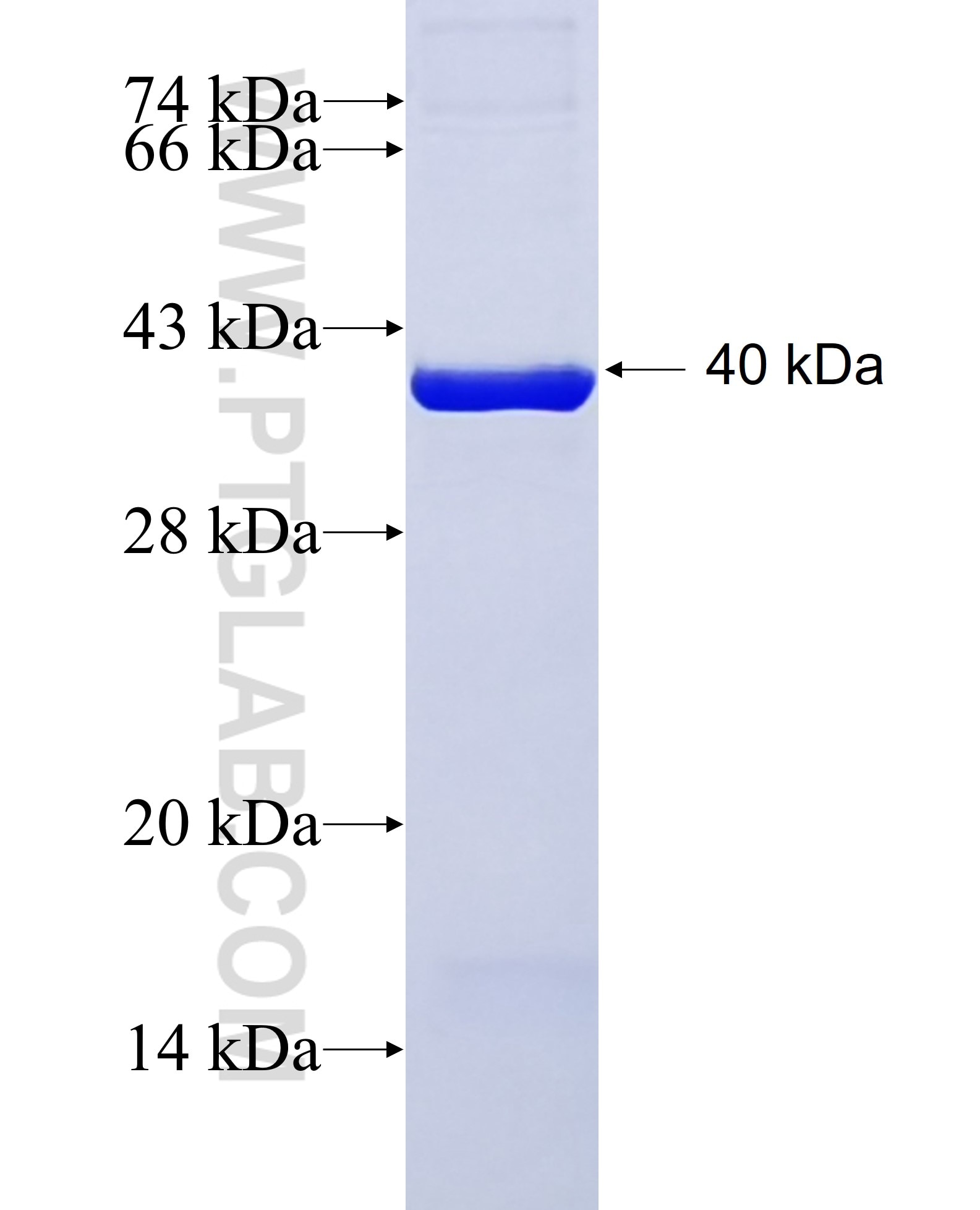 C9orf78 fusion protein Ag5919 SDS-PAGE