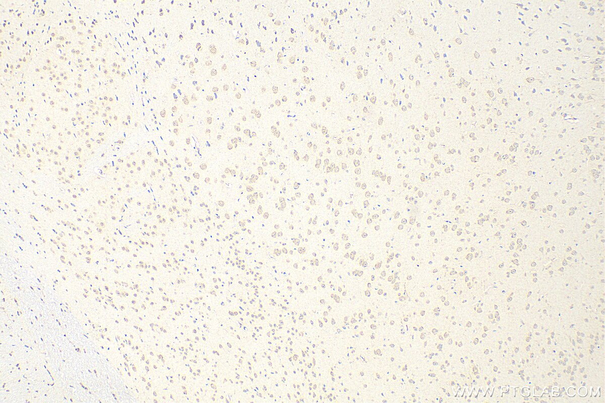 Immunohistochemistry (IHC) staining of mouse brain tissue using C9orf80 Polyclonal antibody (26127-1-AP)