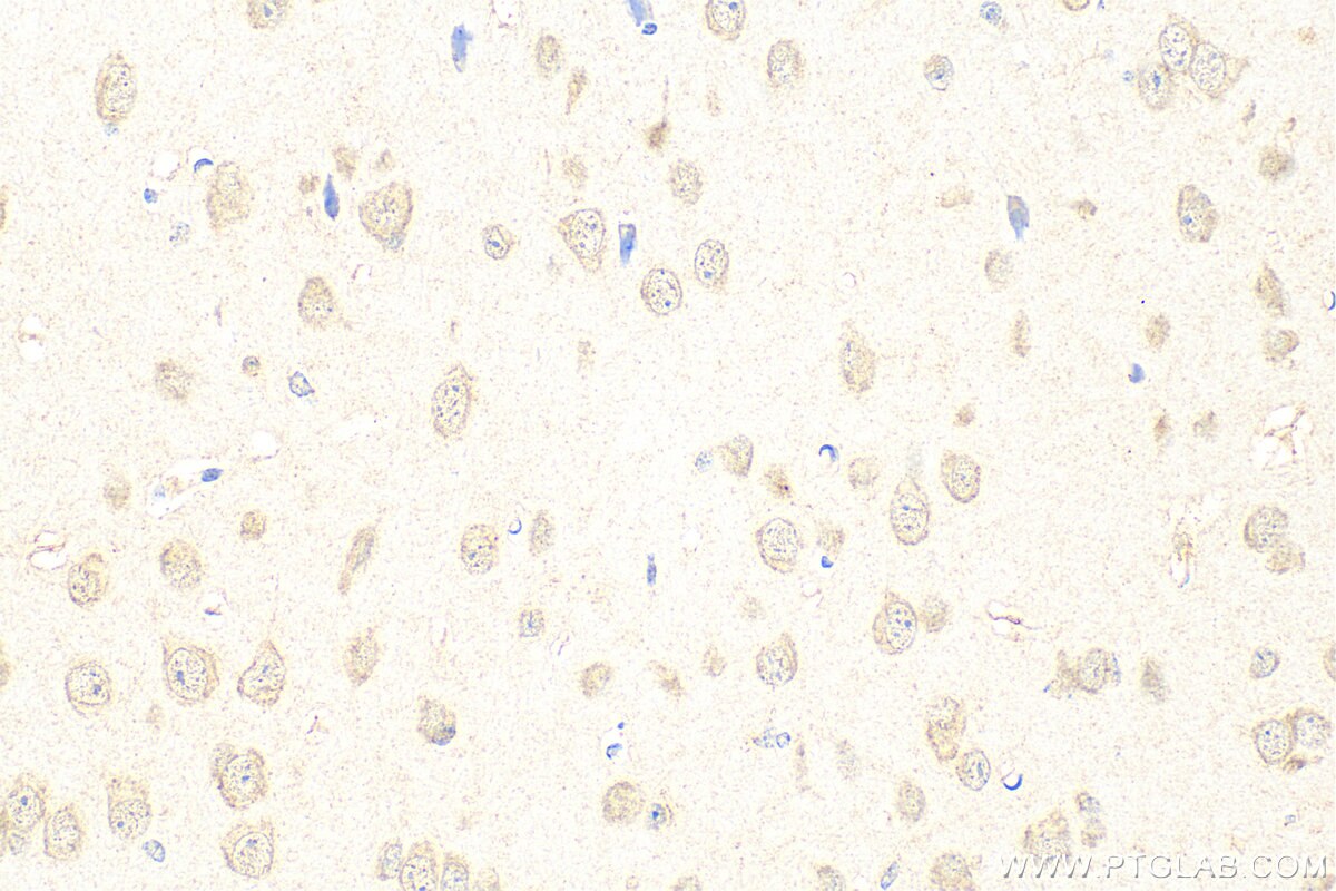 Immunohistochemistry (IHC) staining of mouse brain tissue using C9orf80 Polyclonal antibody (26127-1-AP)