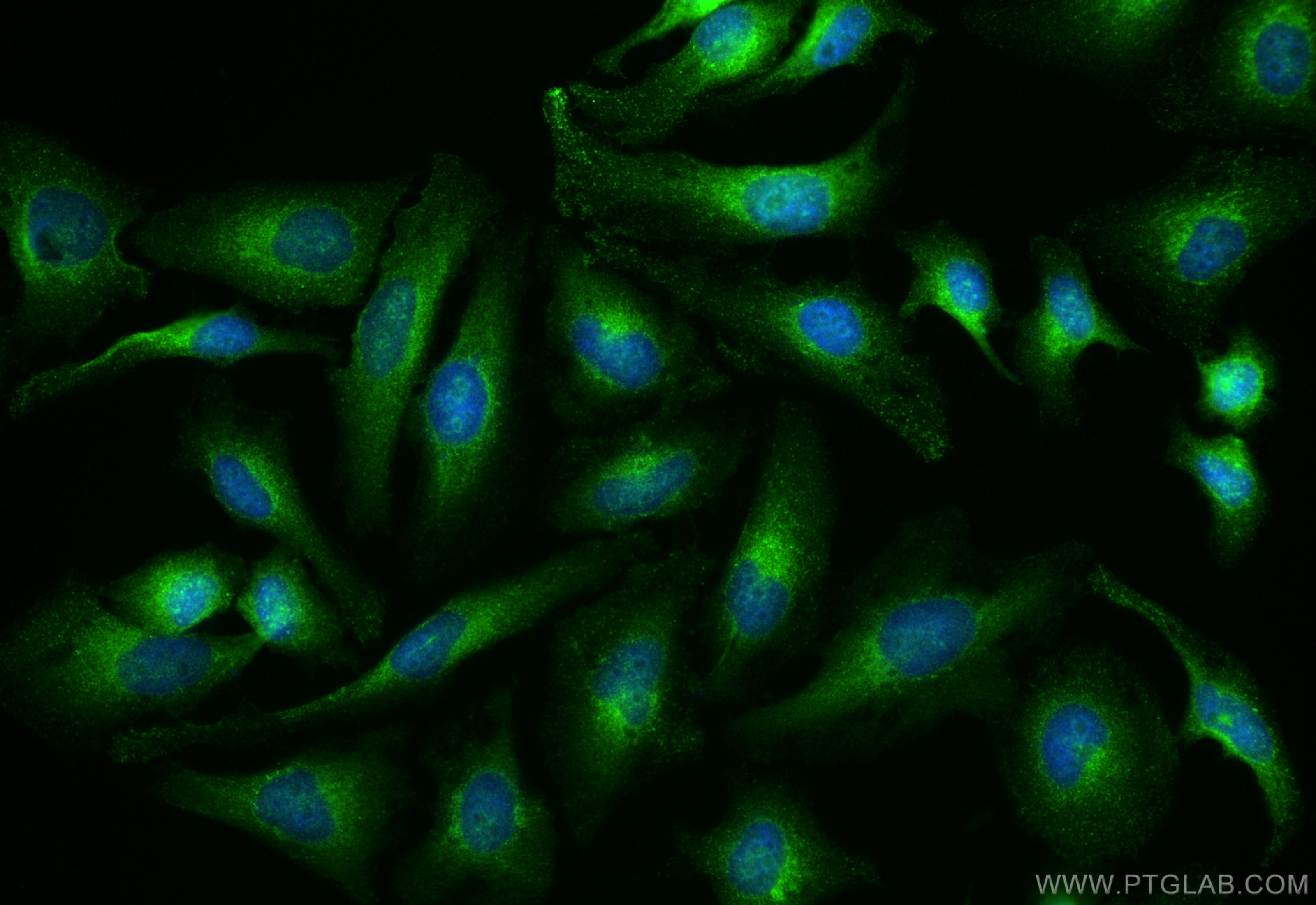 Immunofluorescence (IF) / fluorescent staining of HeLa cells using C9orf86 Polyclonal antibody (20848-1-AP)