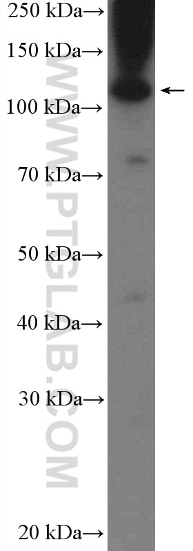 Western Blot (WB) analysis of MDA-MB-453s cells using C9orf86 Polyclonal antibody (20848-1-AP)