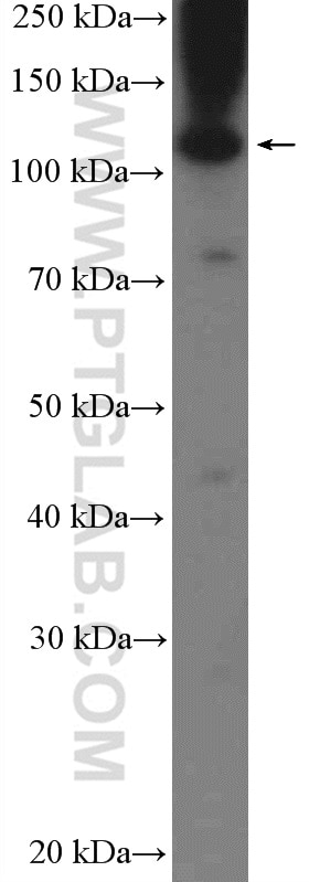 WB analysis of MDA-MB-453s using 20848-1-AP