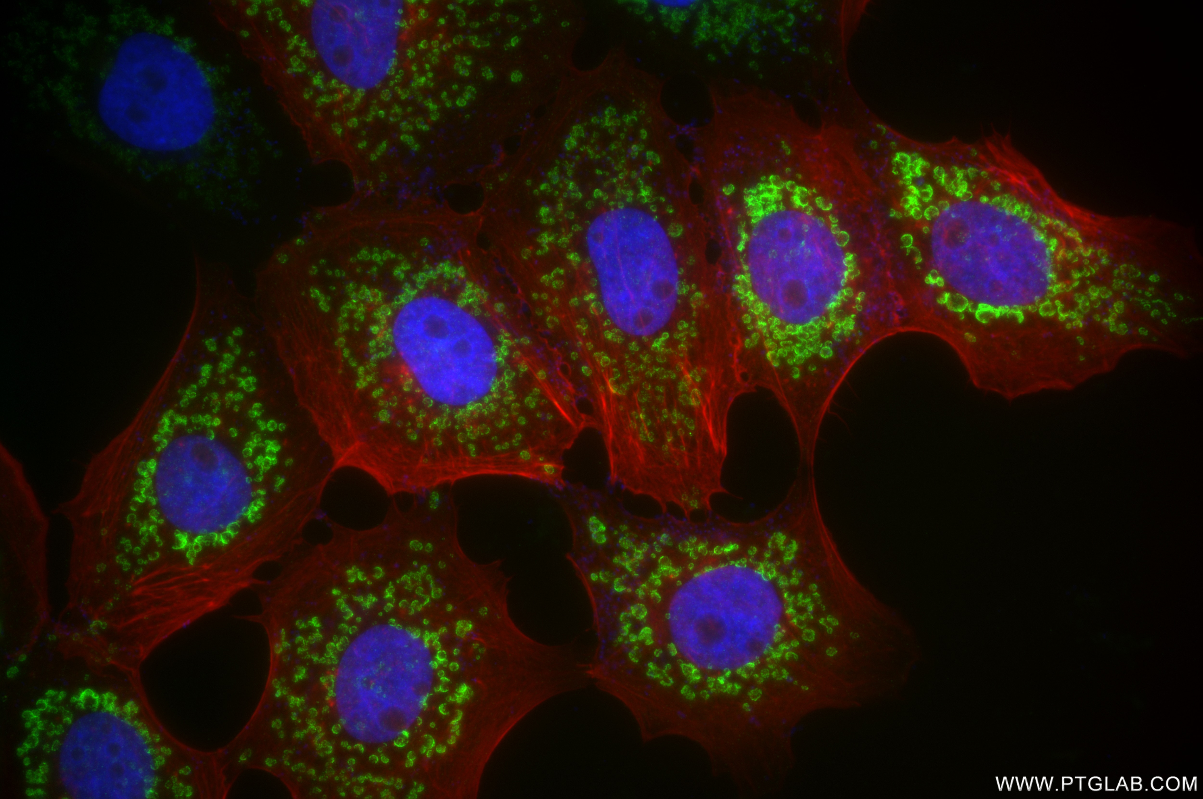 Immunofluorescence (IF) / fluorescent staining of A431 cells using C9orf89 Recombinant antibody (85357-1-RR)