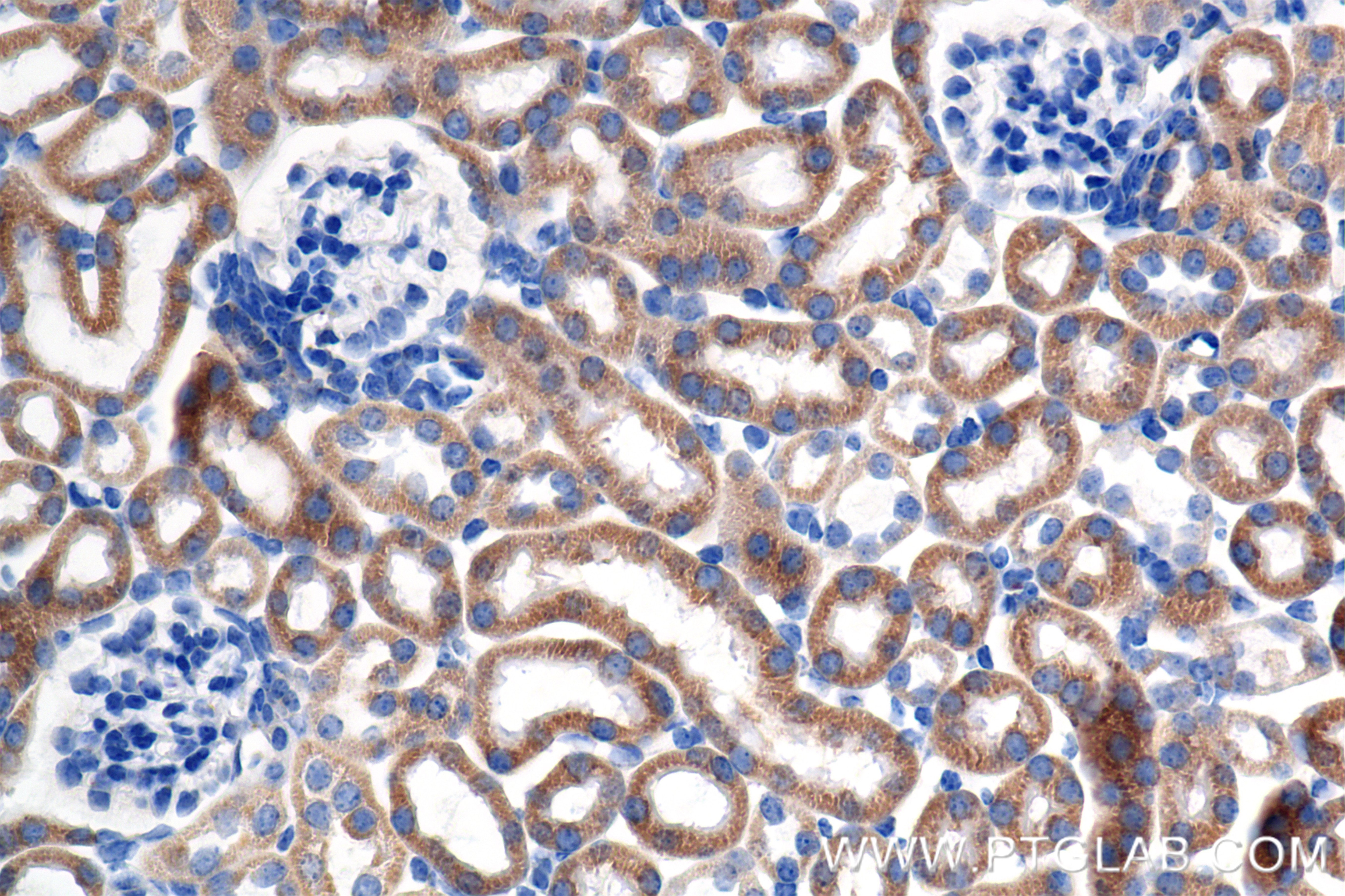 Immunohistochemistry (IHC) staining of mouse kidney tissue using C9orf89 Recombinant antibody (85357-1-RR)