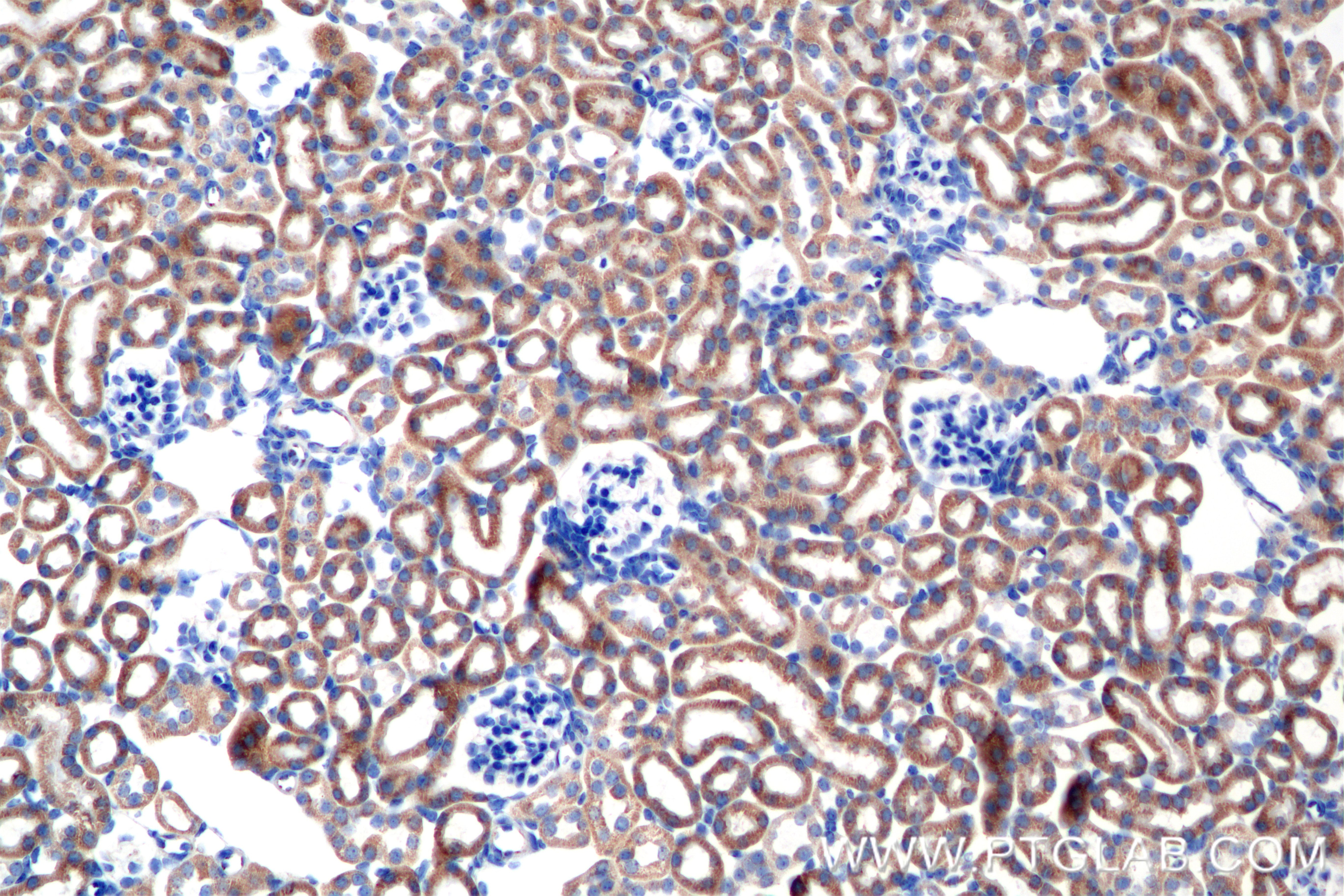 Immunohistochemistry (IHC) staining of mouse kidney tissue using C9orf89 Recombinant antibody (85357-1-RR)