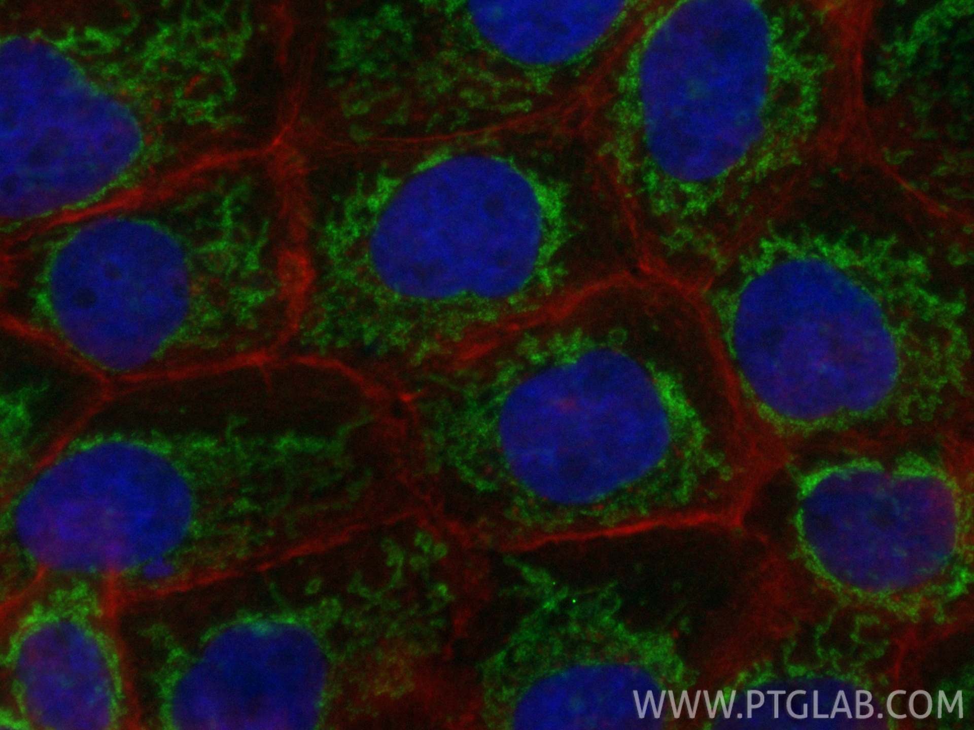 Immunofluorescent analysis of (4% PFA) fixed A431 cells using CoraLite® Plus 488 C9orf89 antibody (CL488-85357, Clone: 242638F7 ) at dilution of 1:200, CL594-phalloidin (red). Immunofluorescence (IF) / fluorescent staining of A431 cells using CoraLite® Plus 488-conjugated C9orf89 Recombinant (CL488-85357)