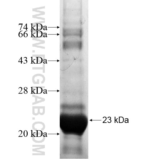 C9orf89 fusion protein Ag15098 SDS-PAGE