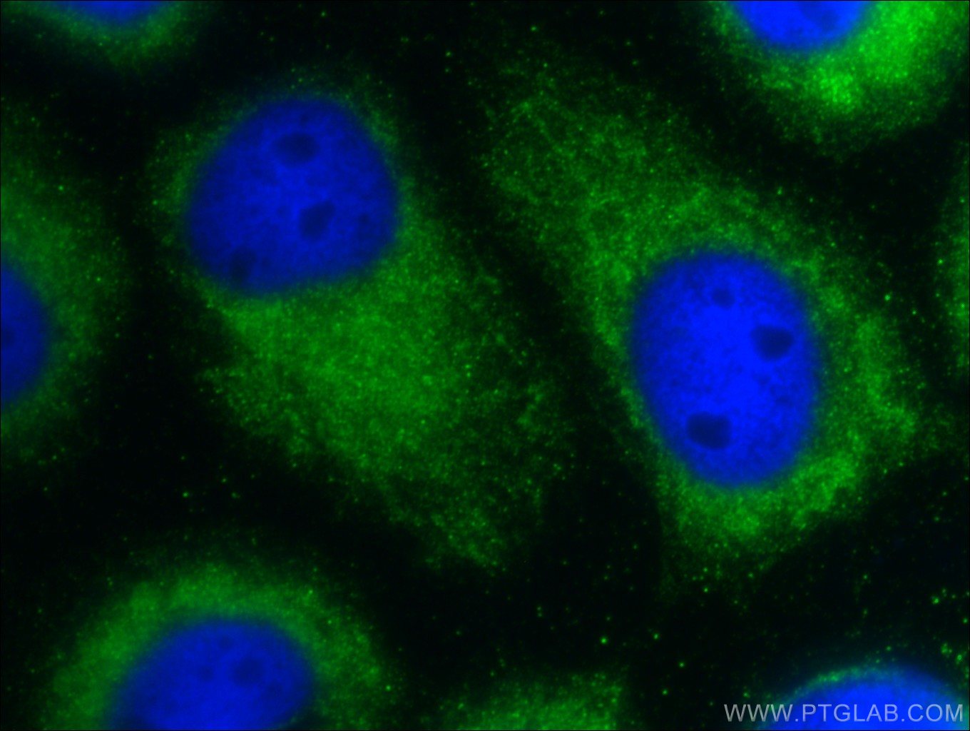 Immunofluorescence (IF) / fluorescent staining of A431 cells using SPACA9 Polyclonal antibody (26034-1-AP)