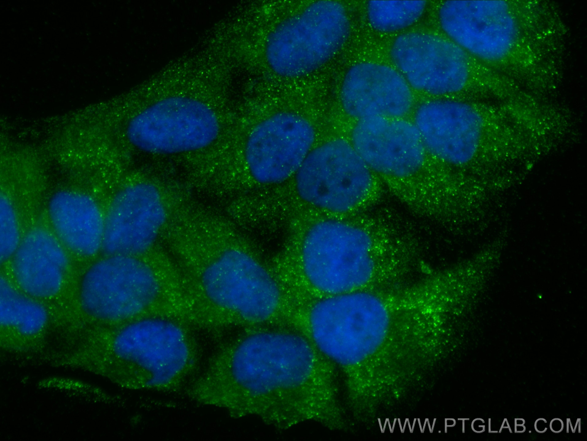 Immunofluorescence (IF) / fluorescent staining of HaCaT cells using SPACA9 Polyclonal antibody (26034-1-AP)