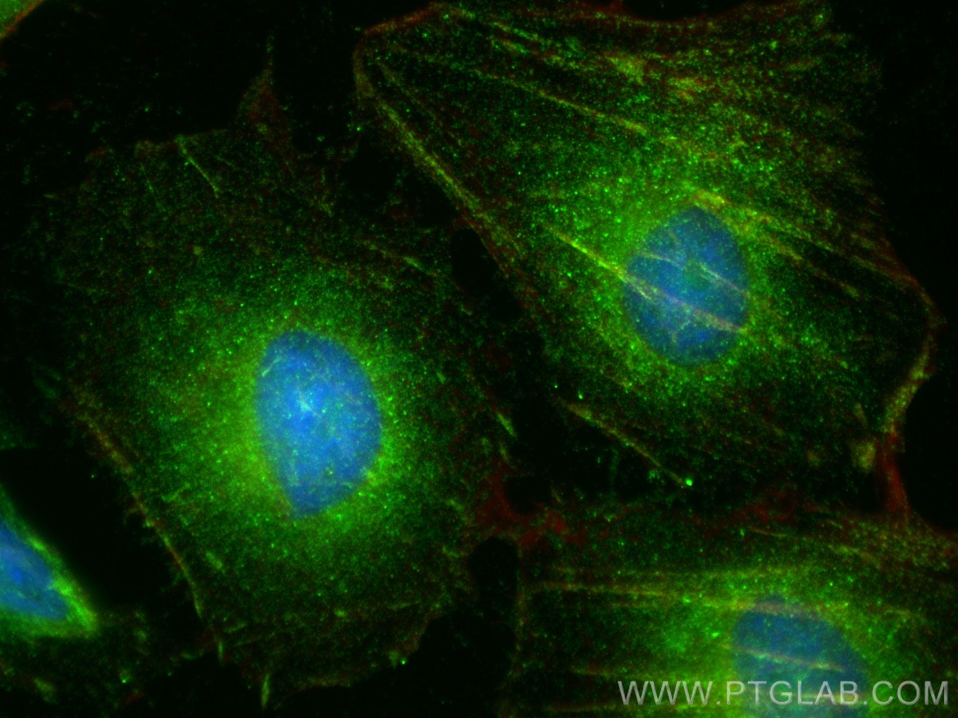 Immunofluorescence (IF) / fluorescent staining of HeLa cells using SPACA9 Polyclonal antibody (26034-1-AP)