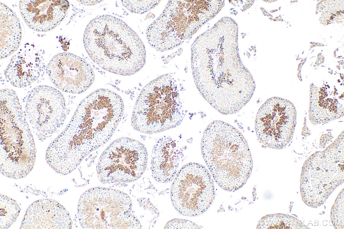 Immunohistochemistry (IHC) staining of mouse testis tissue using SPACA9 Polyclonal antibody (26034-1-AP)