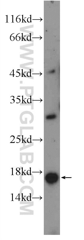 Western Blot (WB) analysis of mouse testis tissue using SPACA9 Polyclonal antibody (26034-1-AP)