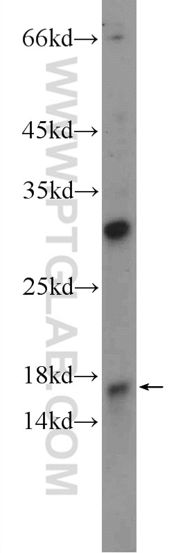 Western Blot (WB) analysis of rat testis tissue using SPACA9 Polyclonal antibody (26034-1-AP)