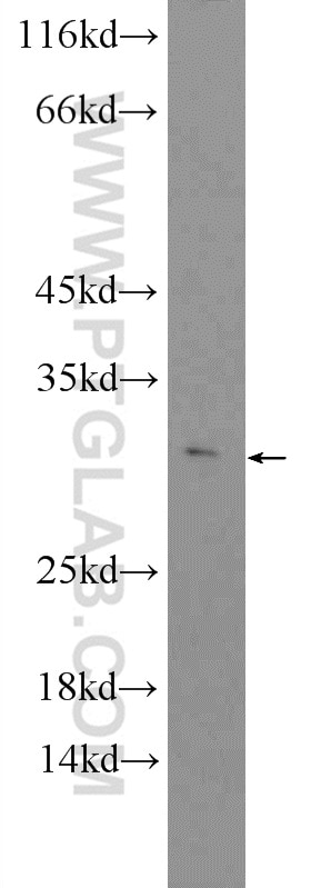Western Blot (WB) analysis of mouse liver tissue using SPACA9 Polyclonal antibody (26034-1-AP)