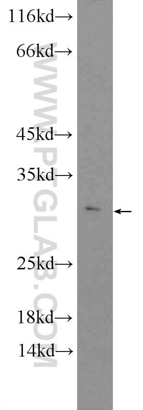 WB analysis of mouse liver using 26034-1-AP