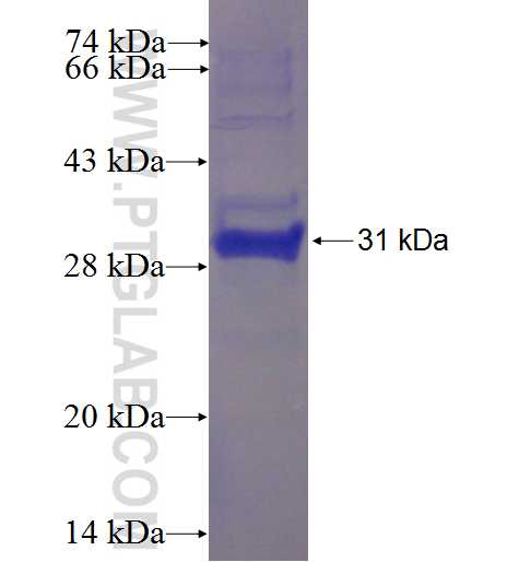 C9orf9 fusion protein Ag23328 SDS-PAGE