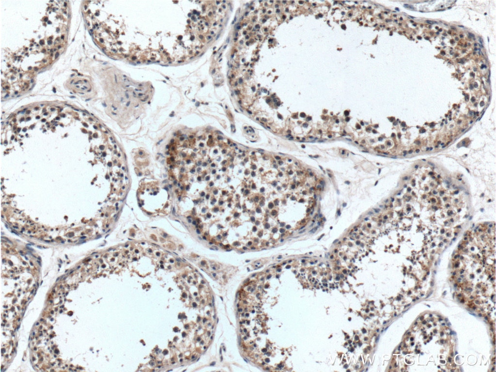 Immunohistochemistry (IHC) staining of human testis tissue using C9orf98 Polyclonal antibody (21036-1-AP)