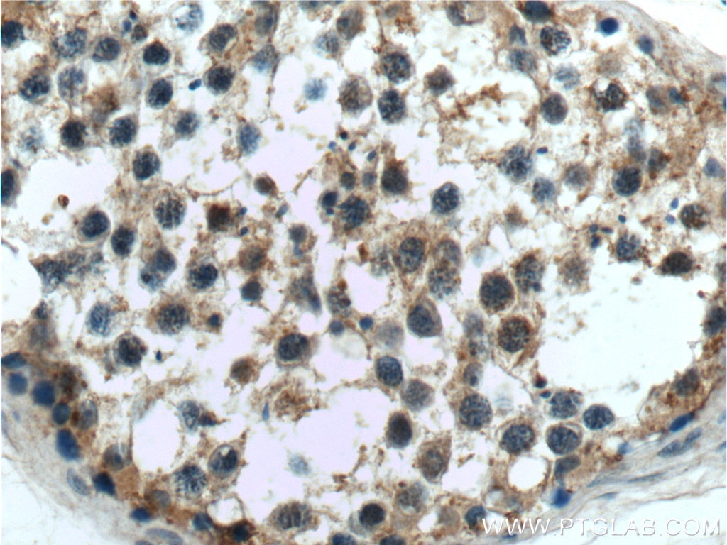 Immunohistochemistry (IHC) staining of human testis tissue using C9orf98 Polyclonal antibody (21036-1-AP)