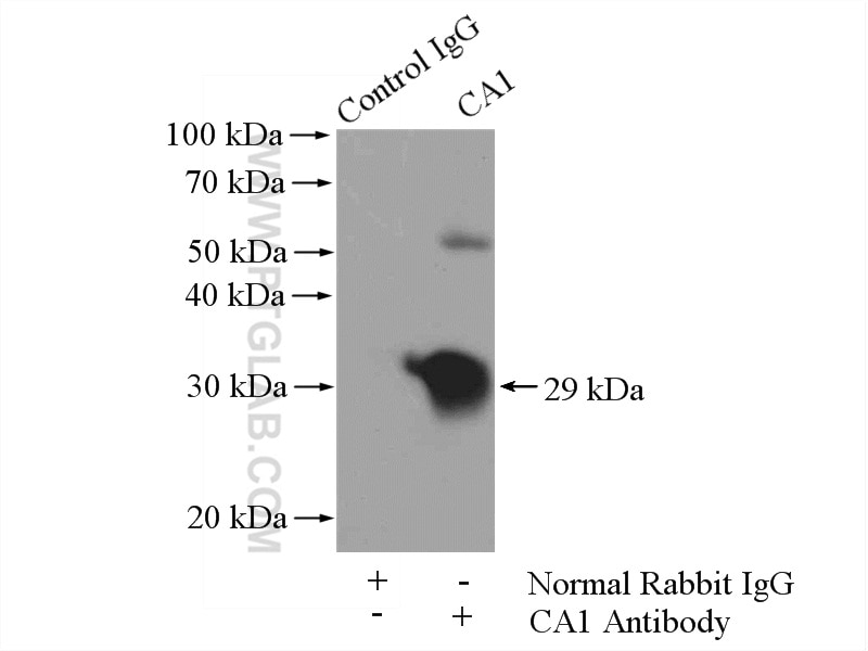 Immunoprecipitation (IP) experiment of K-562 cells using CA1 Polyclonal antibody (13198-2-AP)
