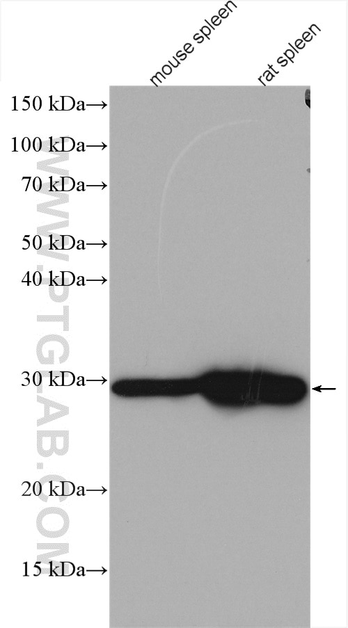 Western Blot (WB) analysis of various lysates using CA1 Polyclonal antibody (13198-2-AP)