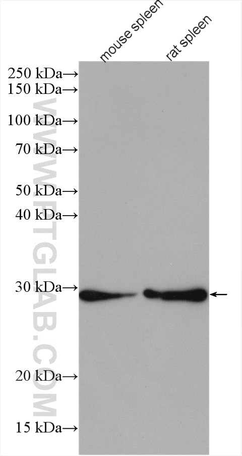 Western Blot (WB) analysis of various lysates using CA1 Polyclonal antibody (13198-2-AP)