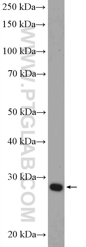 Western Blot (WB) analysis of mouse spleen tissue using CA1 Polyclonal antibody (13198-2-AP)