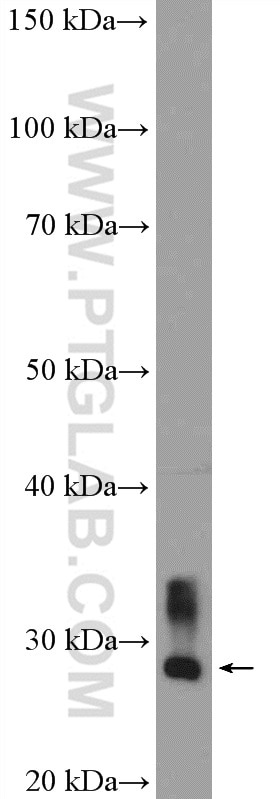 Western Blot (WB) analysis of rat spleen tissue using CA1 Polyclonal antibody (13198-2-AP)