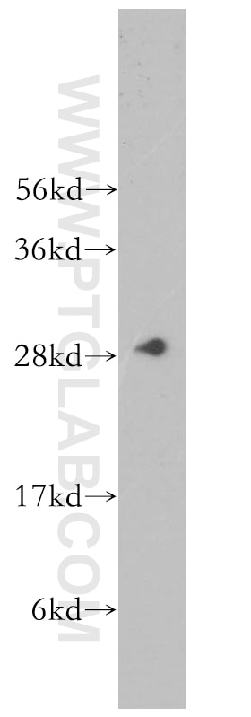 Western Blot (WB) analysis of Jurkat cells using CA1 Polyclonal antibody (13198-2-AP)