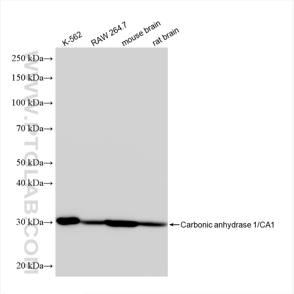 Western Blot (WB) analysis of various lysates using CA1 Recombinant antibody (86000-1-RR)