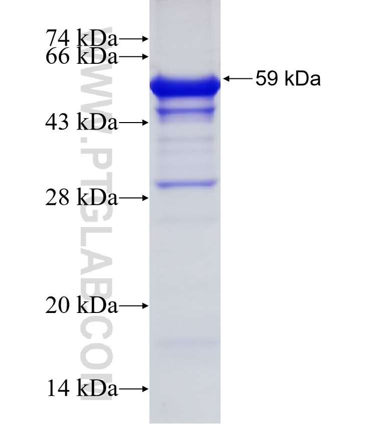 CA10 fusion protein Ag3652 SDS-PAGE