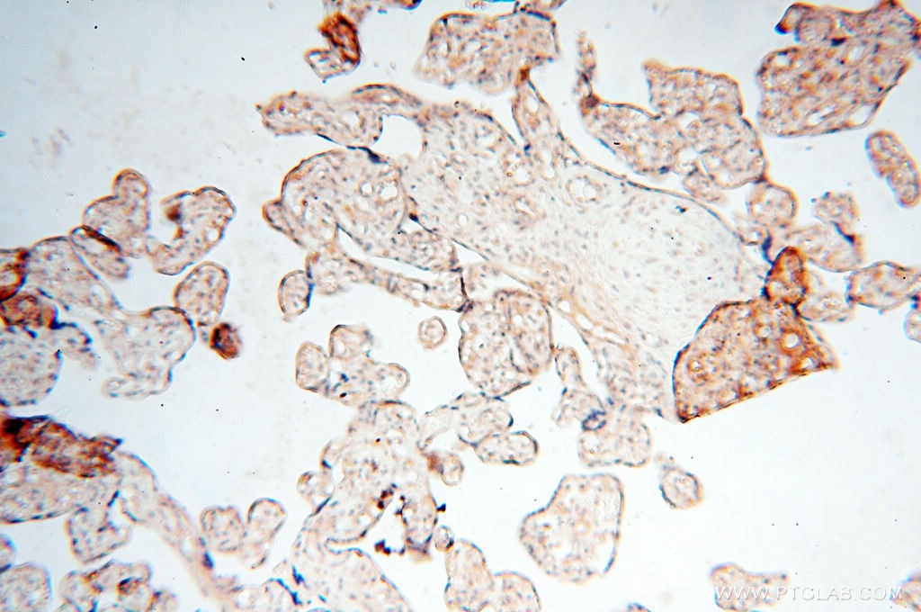 Immunohistochemistry (IHC) staining of human placenta tissue using CA11 Polyclonal antibody (15435-1-AP)