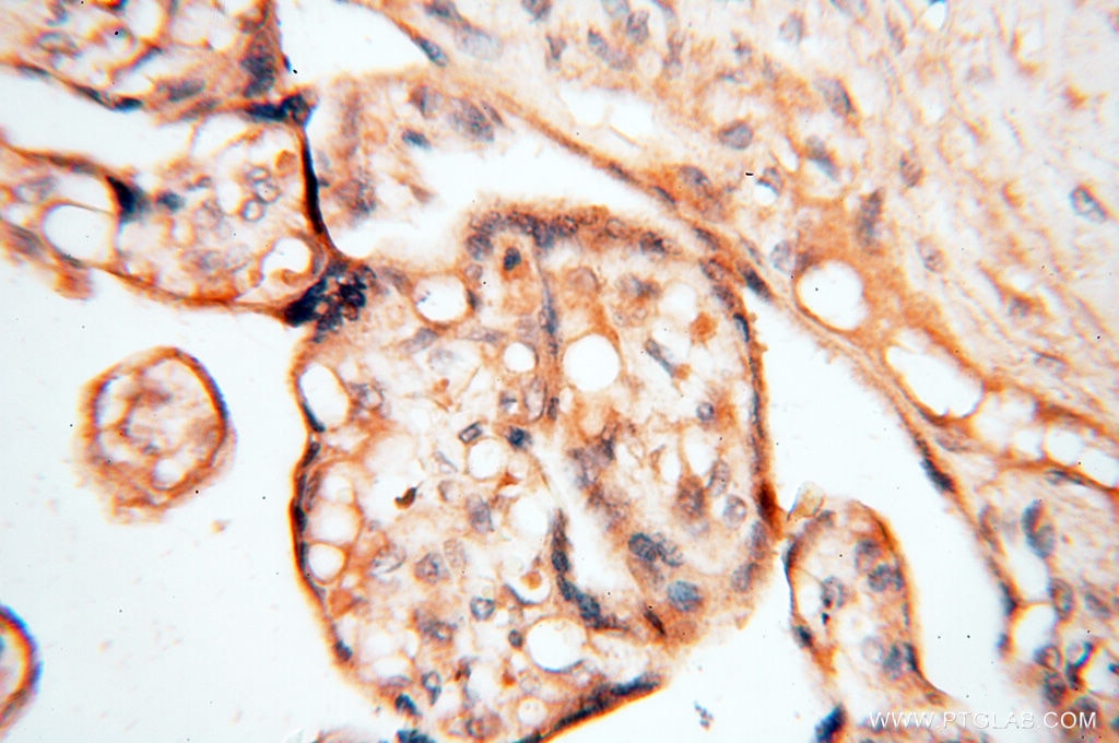 Immunohistochemistry (IHC) staining of human placenta tissue using CA11 Polyclonal antibody (15435-1-AP)